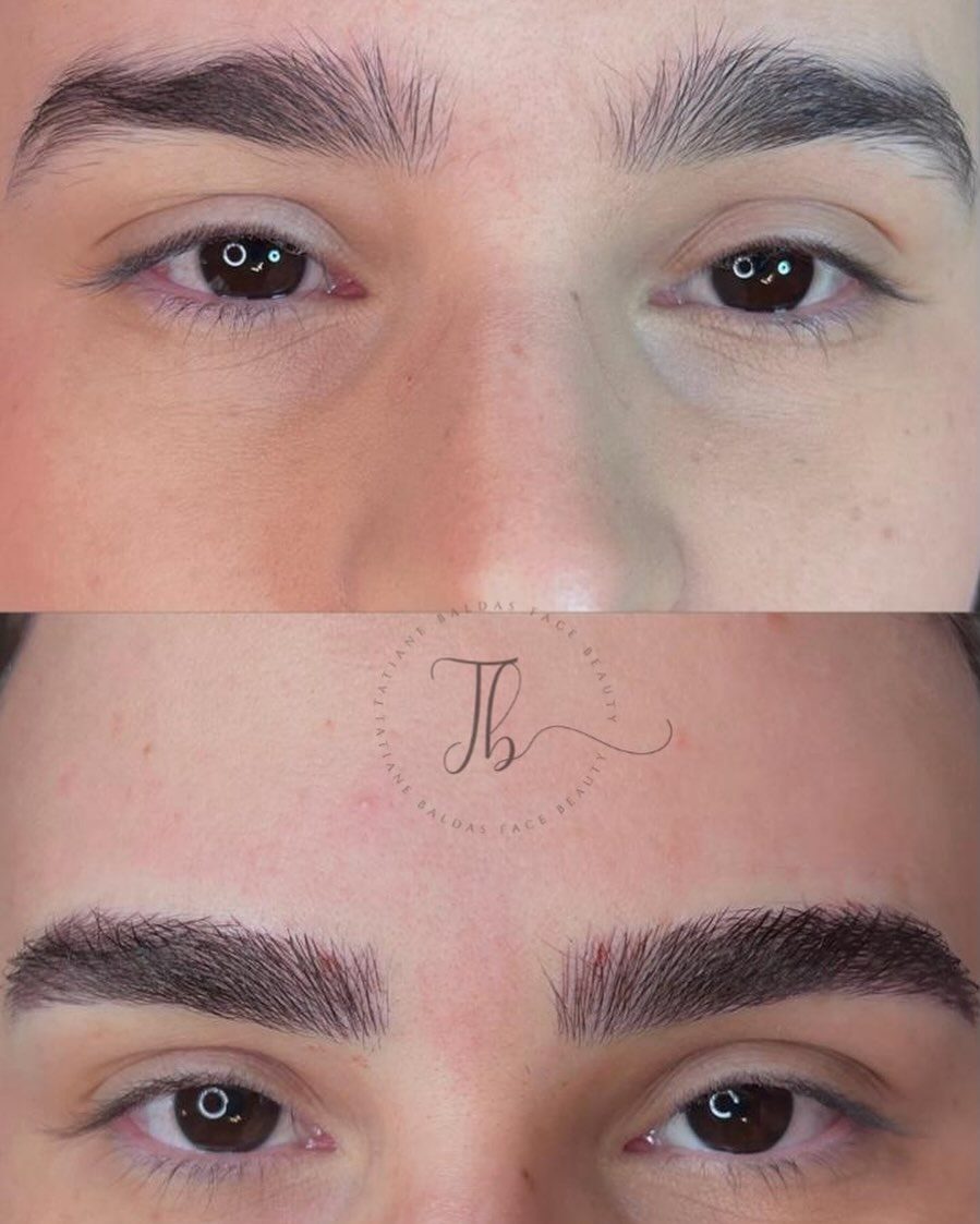 Antes e depois 1