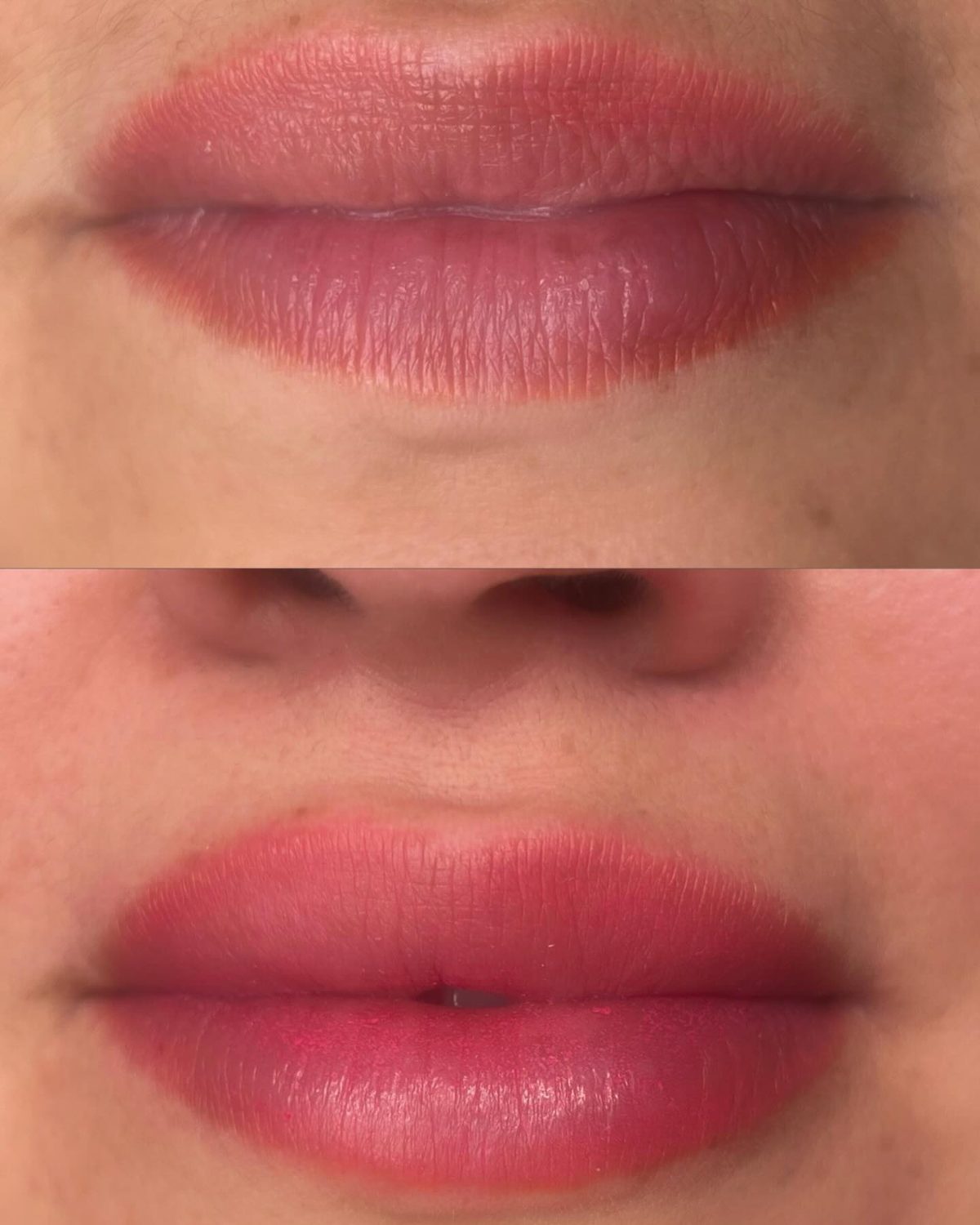 Antes e depois 2