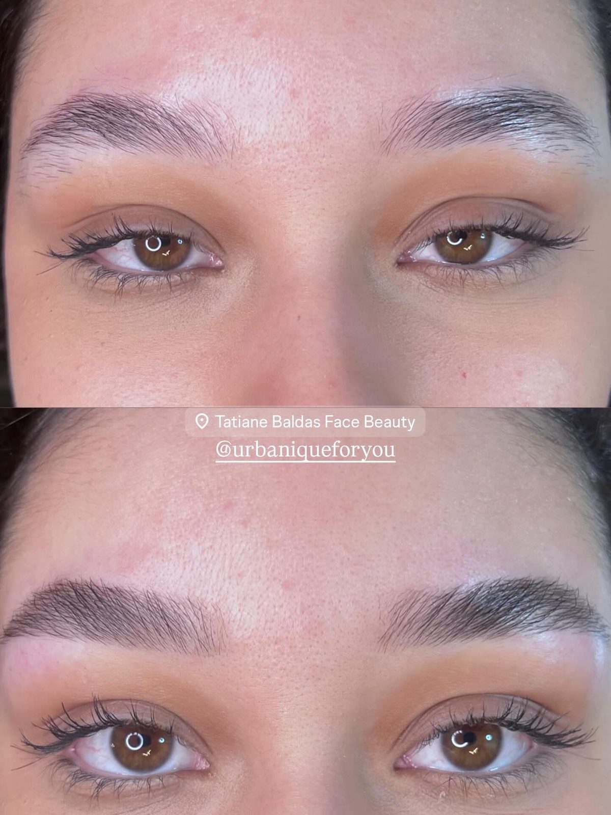 Antes e depois 3