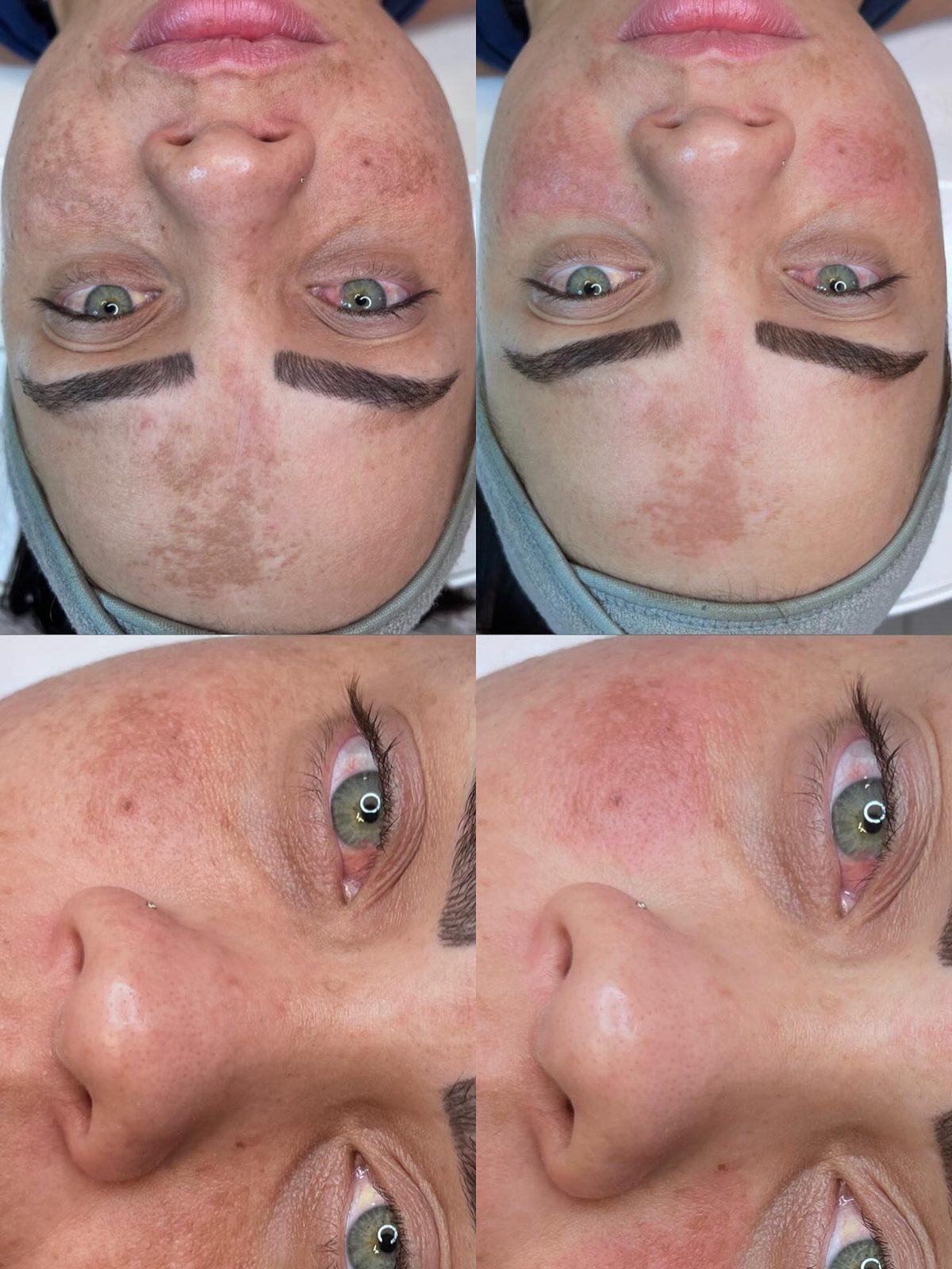 Antes e depois 4