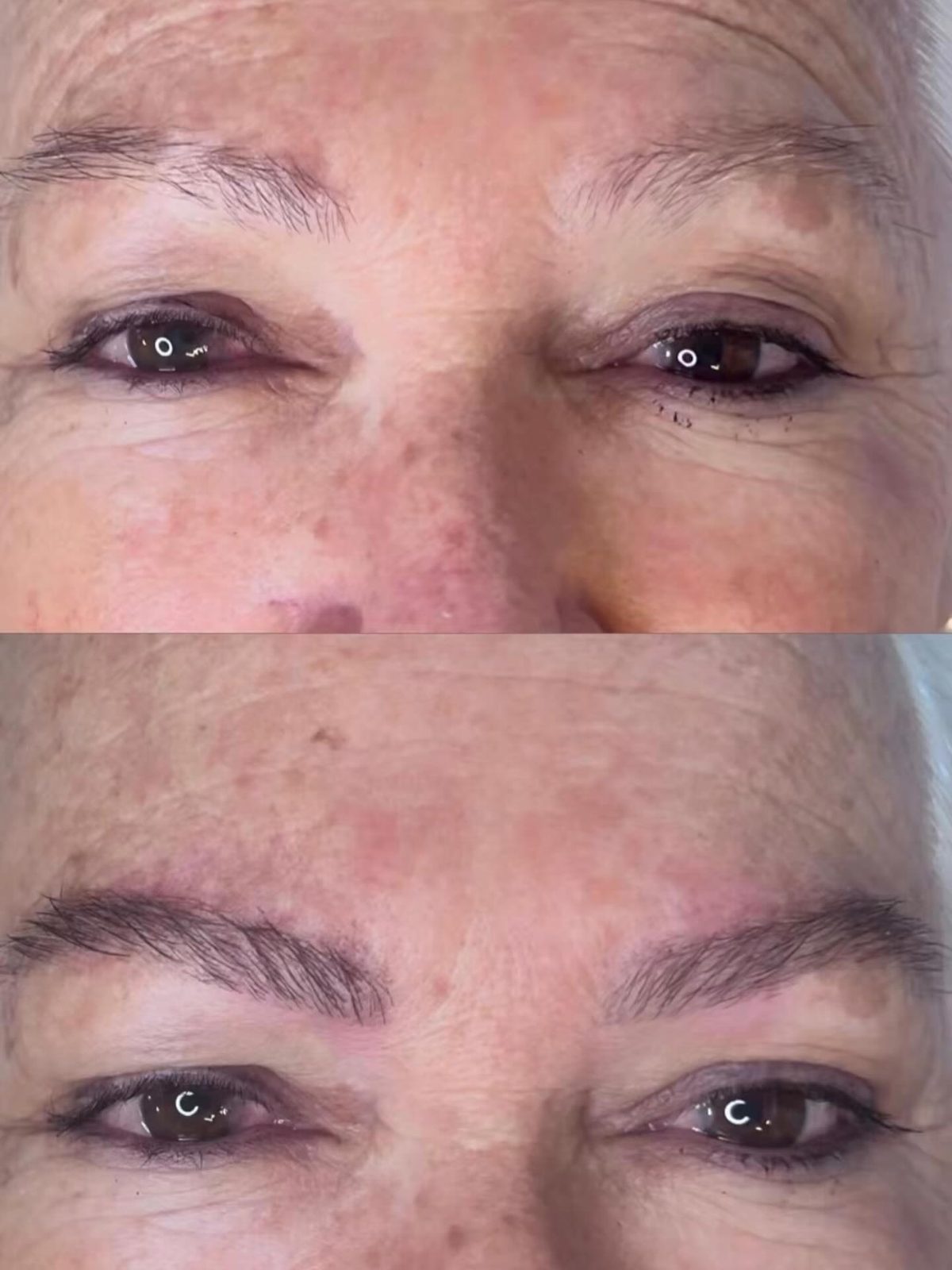 Antes e depois 5