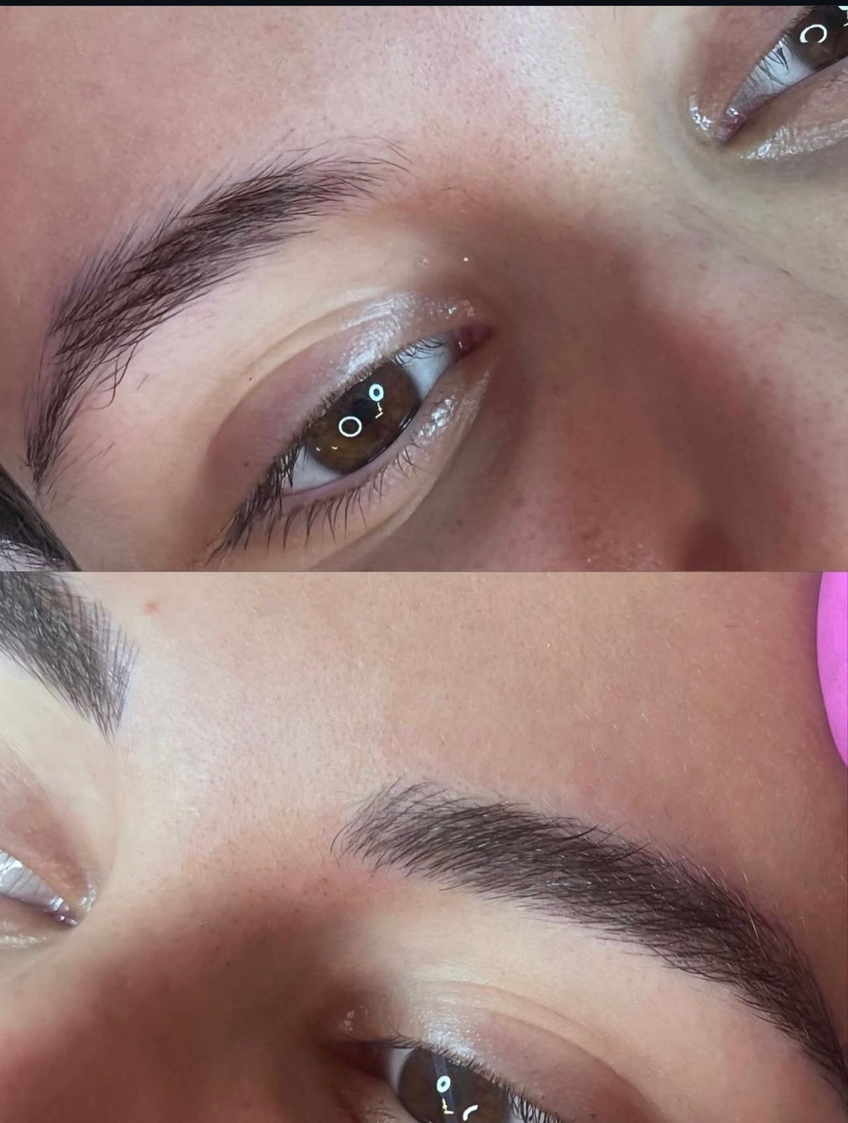 Antes e depois 8