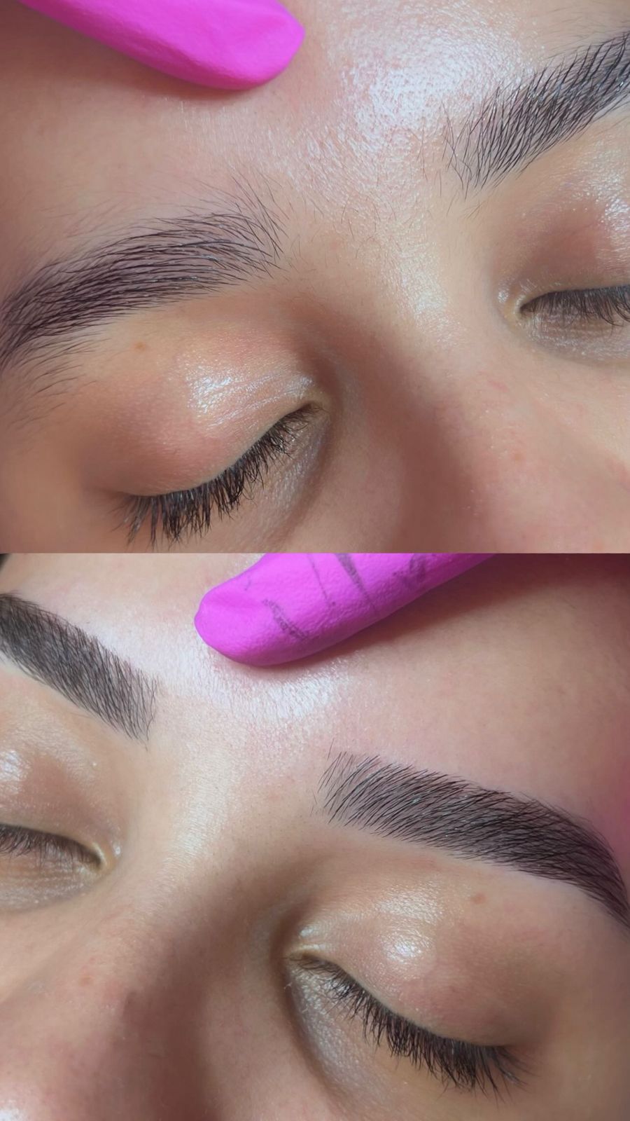 Antes e depois 8